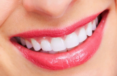 Làm thế nào để có hàm răng đẹp bằng niềng răng?